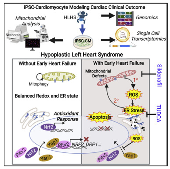 استرس اکسیداتیو میتوکندری جبران نشده زمینه‌ساز نارسایی قلبی در مدلی از بیماری مادرزادی قلبی مشتق شده از iPSC 